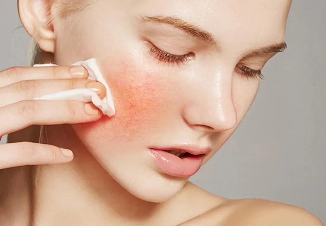 PHỤC HỒI HÀNG RÀO BẢO VỆ DA – BÍ QUYẾT GIÚP DA KHỎE ĐẸP TỪ BÊN TRONG
